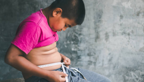What Causes Obesity in Children